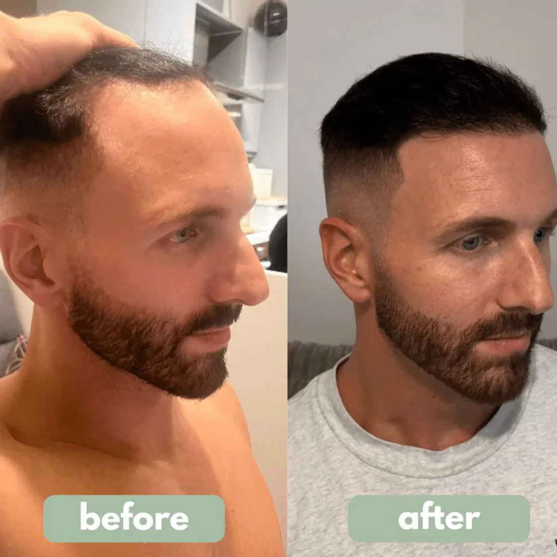 Hair Growth Roll-On Serum