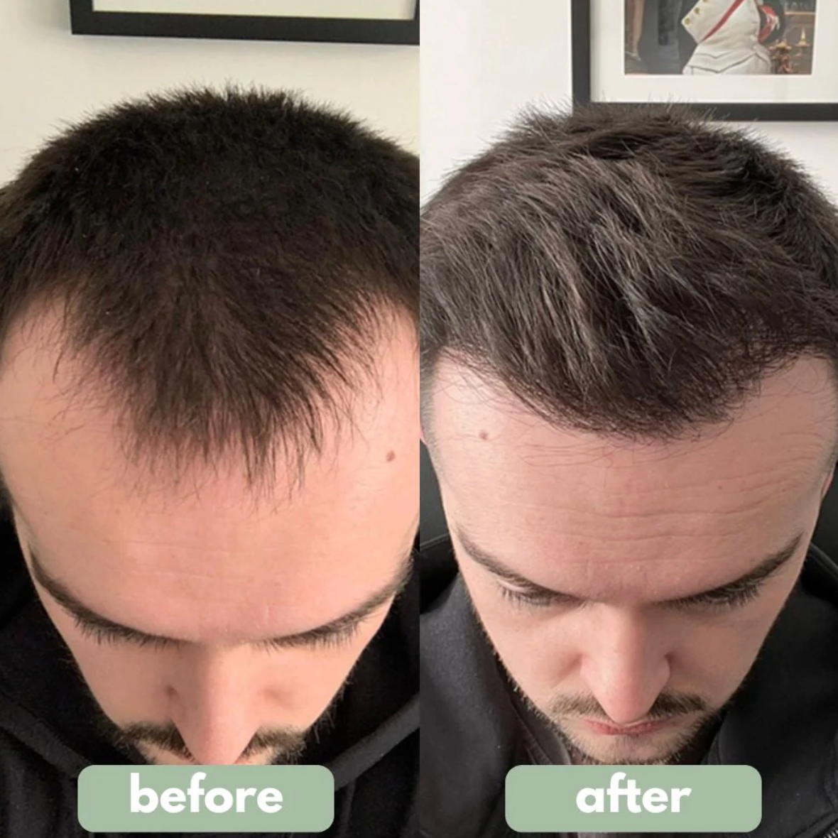 Hair Growth Roll-On Serum